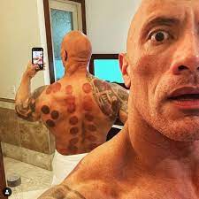 cupping marks the rock